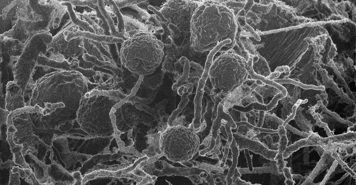 Microscopic photo of N.californiae