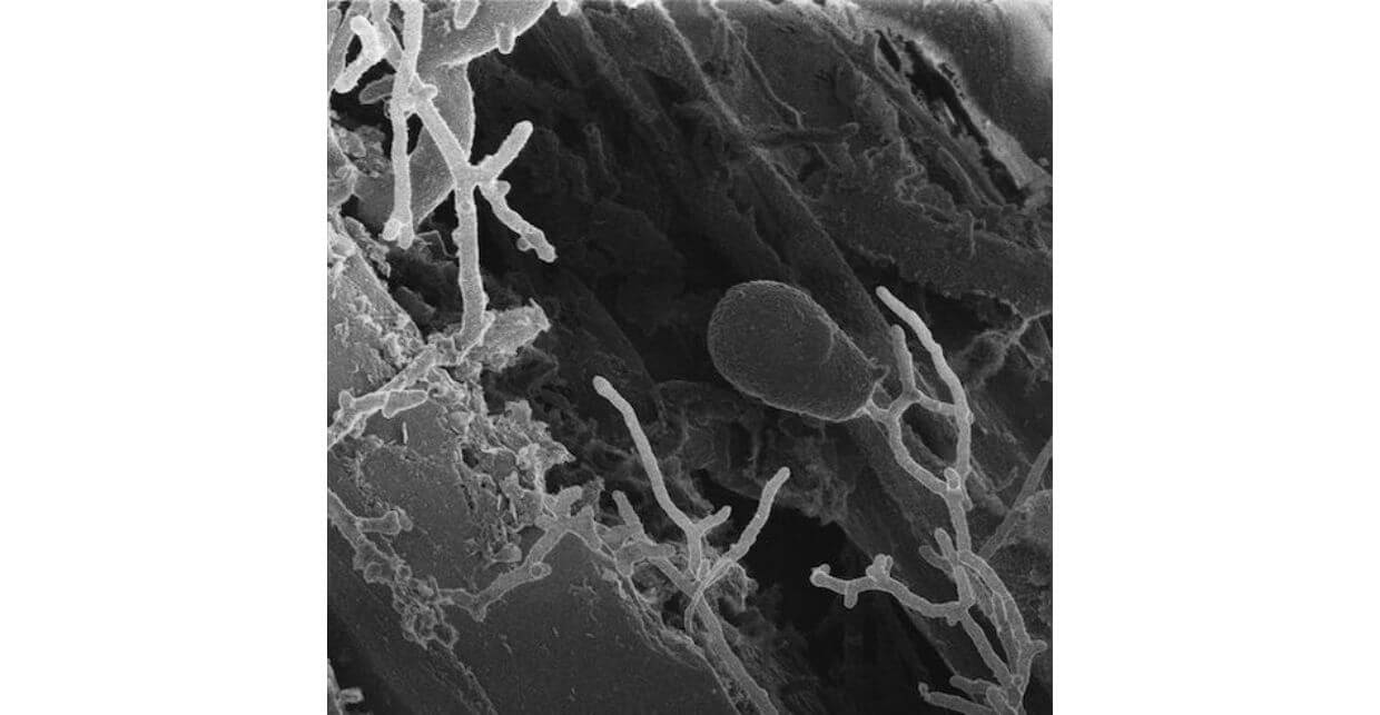 Microscopic photo of fungi