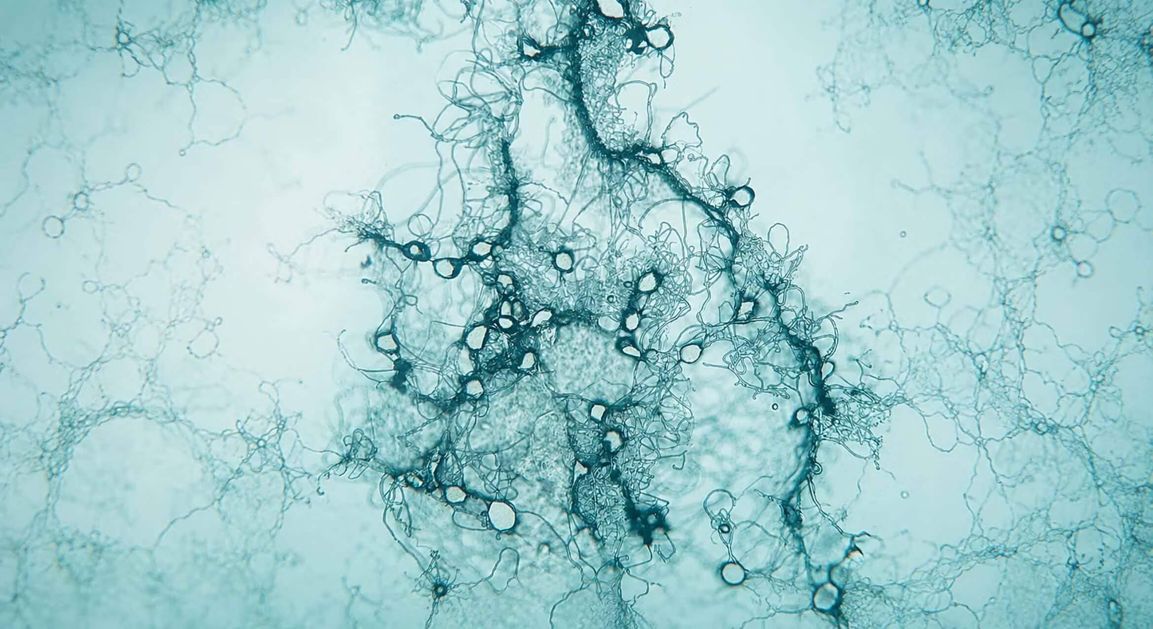 Anaerobic gut fungi through a microscope